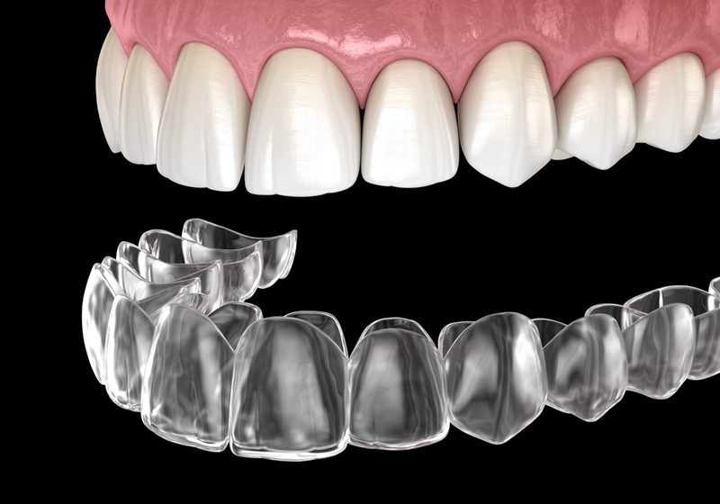 invisalign-tray
