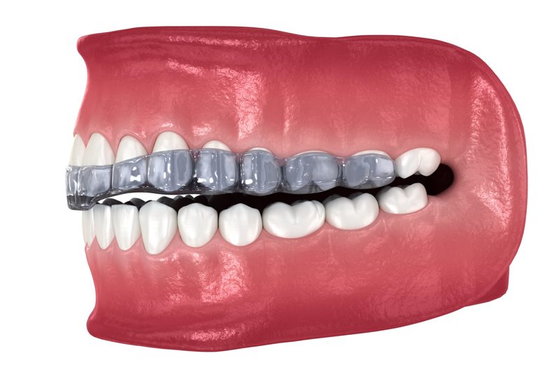 occlusal-guard