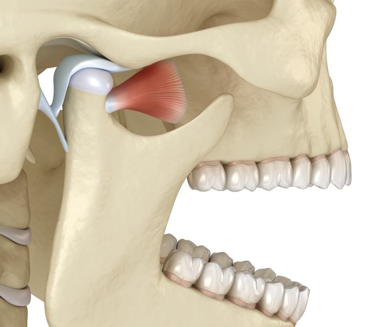 tmd-myofacial-pain-therapies
